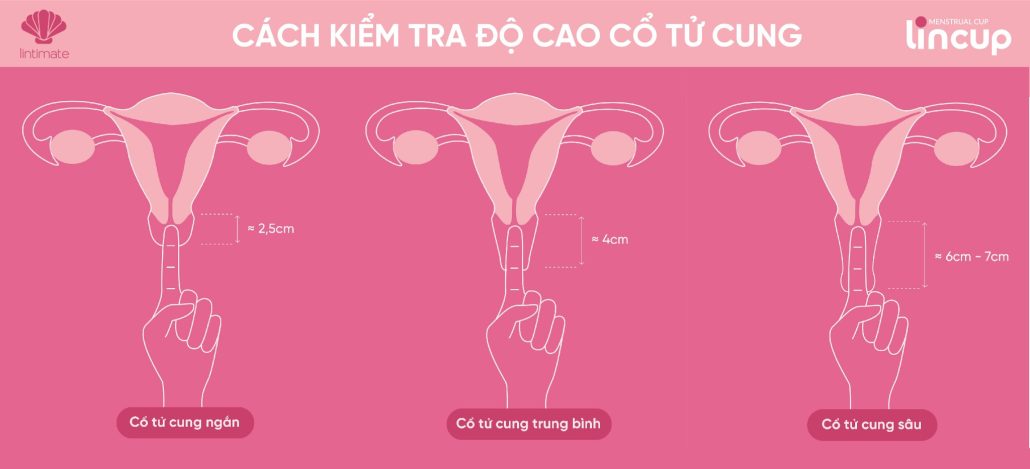 Vì sao bạn nên kiểm tra độ cao cổ tử cung trước khi sử dụng cốc nguyệt san?