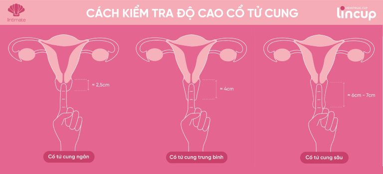 Vì sao bạn nên kiểm tra độ cao cổ tử cung trước khi sử dụng cốc nguyệt san?