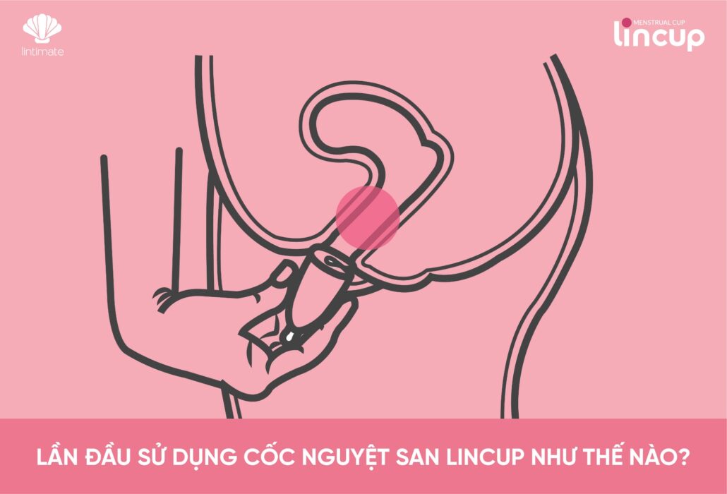 Mẹo cho lần đầu tiên sử dụng cốc nguyệt san Lincup